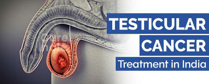 Testicular Cancer